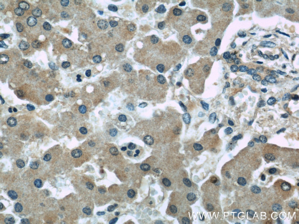 Immunohistochemistry (IHC) staining of human liver tissue using TRPC4AP Monoclonal antibody (66138-1-Ig)