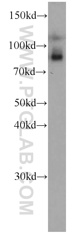 Western Blot (WB) analysis of human heart tissue using TRPC4AP Monoclonal antibody (66138-1-Ig)