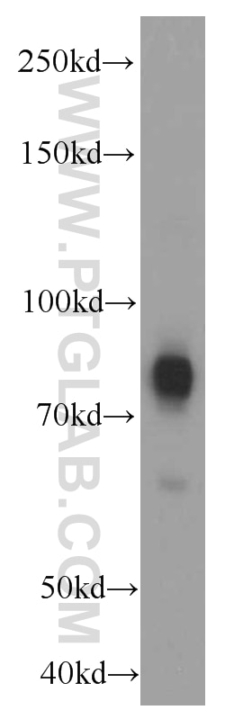 Western Blot (WB) analysis of human brain tissue using TRPC4AP Monoclonal antibody (66138-1-Ig)