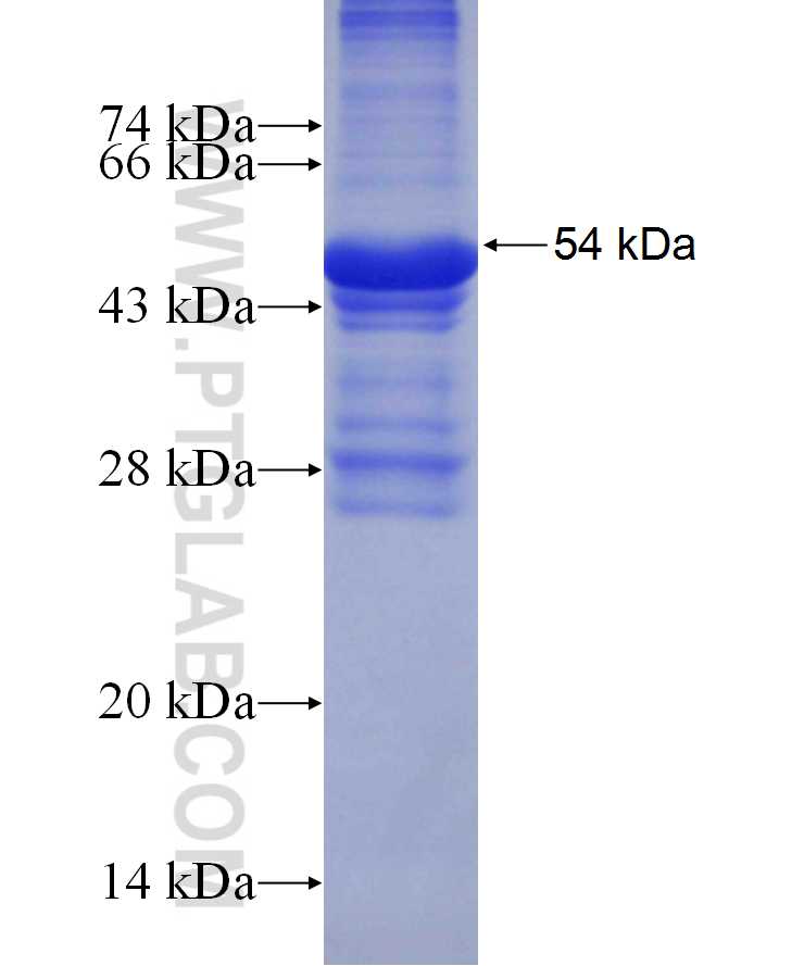 TRPC4AP fusion protein Ag29860 SDS-PAGE