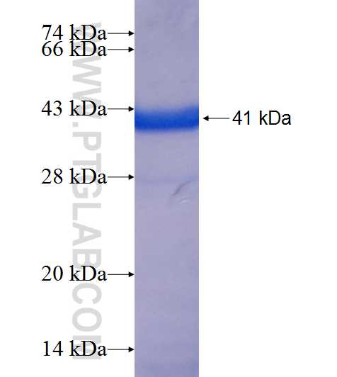 TRPC4AP fusion protein Ag18772 SDS-PAGE