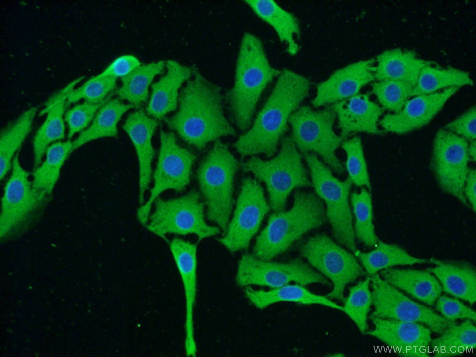 Immunofluorescence (IF) / fluorescent staining of SH-SY5Y cells using TRPC5 Polyclonal antibody (25890-1-AP)