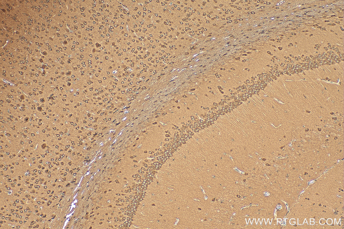 Immunohistochemistry (IHC) staining of mouse brain tissue using TRPC5 Polyclonal antibody (25890-1-AP)