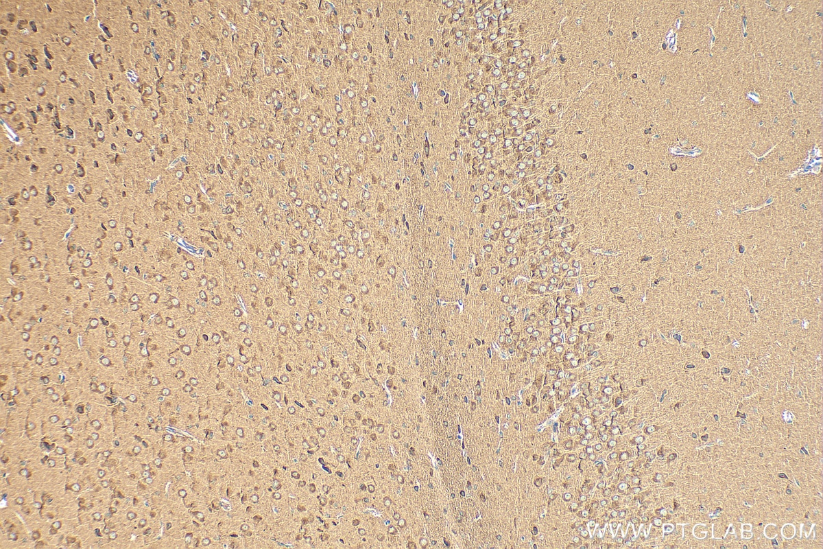 Immunohistochemistry (IHC) staining of rat brain tissue using TRPC5 Polyclonal antibody (25890-1-AP)