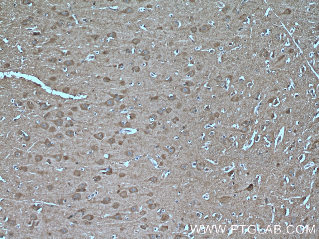 Immunohistochemistry (IHC) staining of human brain tissue using TRPC5 Polyclonal antibody (25890-1-AP)