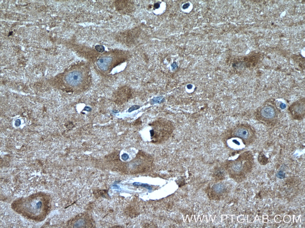 Immunohistochemistry (IHC) staining of human brain tissue using TRPC5 Polyclonal antibody (25890-1-AP)