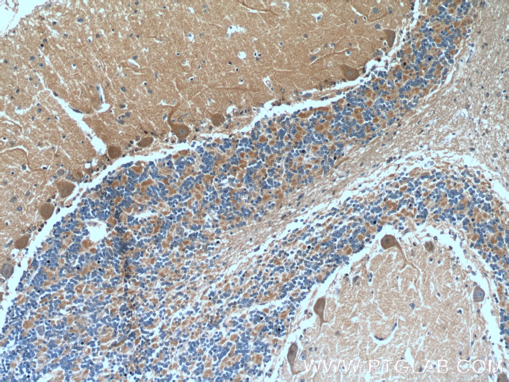 IHC staining of human cerebellum using 25890-1-AP