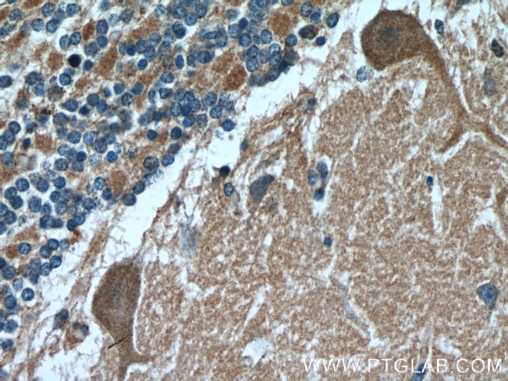 Immunohistochemistry (IHC) staining of human cerebellum tissue using TRPC5 Polyclonal antibody (25890-1-AP)