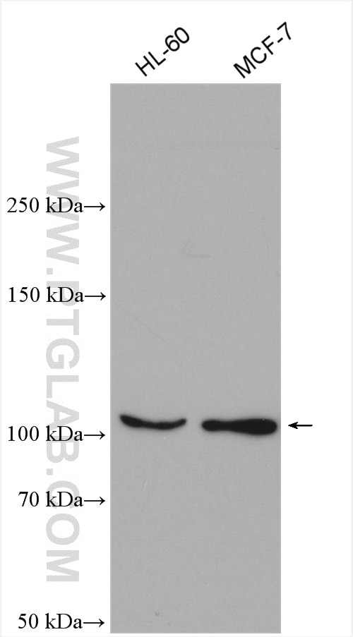 Western Blot (WB) analysis of various lysates using TRPC5 Polyclonal antibody (25890-1-AP)