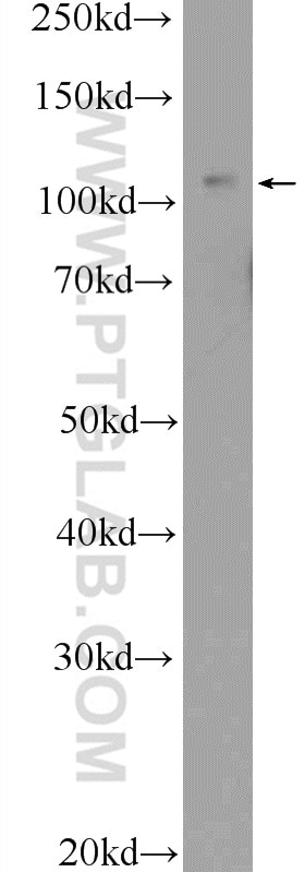 Western Blot (WB) analysis of MCF-7 cells using TRPC5 Polyclonal antibody (25890-1-AP)