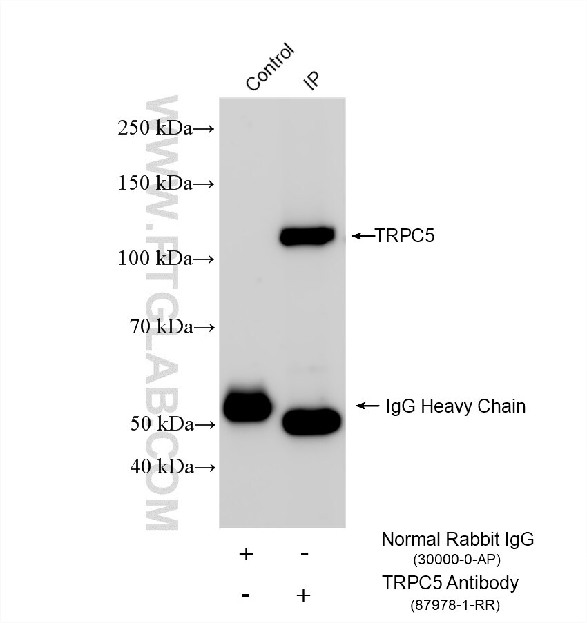 IP experiment of rat brain using 87978-1-RR (same clone as 87978-1-PBS) Immunoprecipitation (IP) experiment of rat brain tissue using TRPC5 Recombinant monoclonal antibody (87978-1-RR)