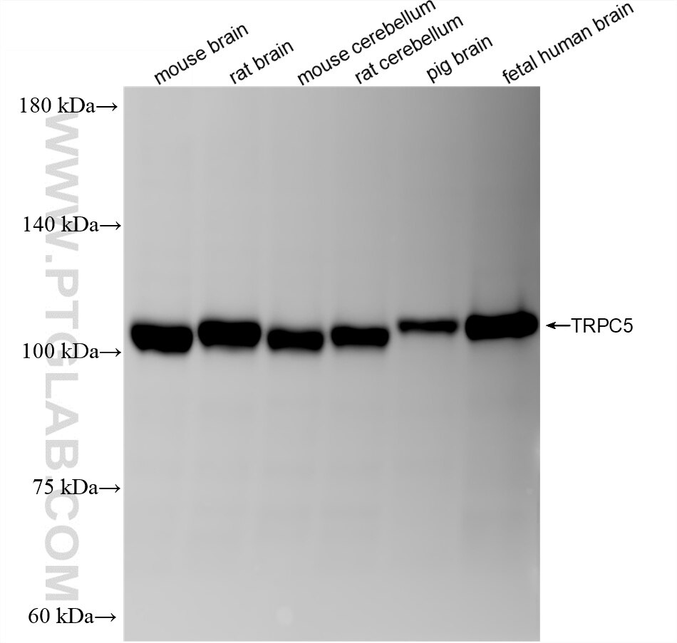 WB analysis using 87978-1-RR (same clone as 87978-1-PBS) Western Blot (WB) analysis of various lysates using TRPC5 Recombinant monoclonal antibody (87978-1-RR)