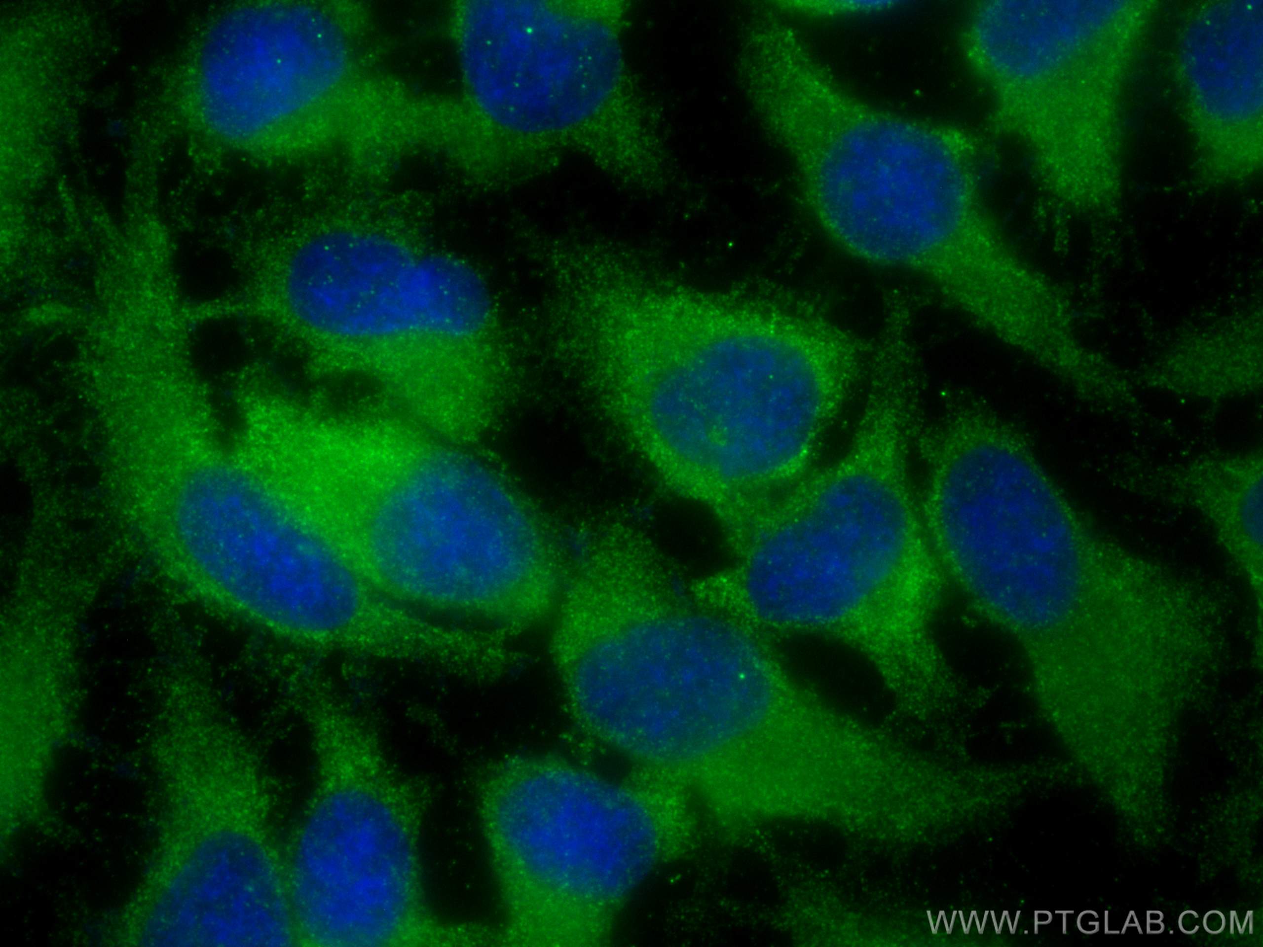 Immunofluorescence (IF) / fluorescent staining of HeLa cells using TRPC6 Polyclonal antibody (18236-1-AP)
