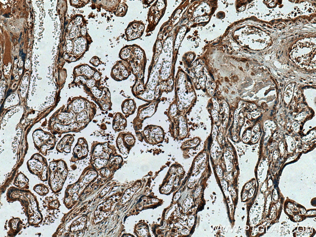 Immunohistochemistry (IHC) staining of human placenta tissue using TRPC6 Polyclonal antibody (18236-1-AP)
