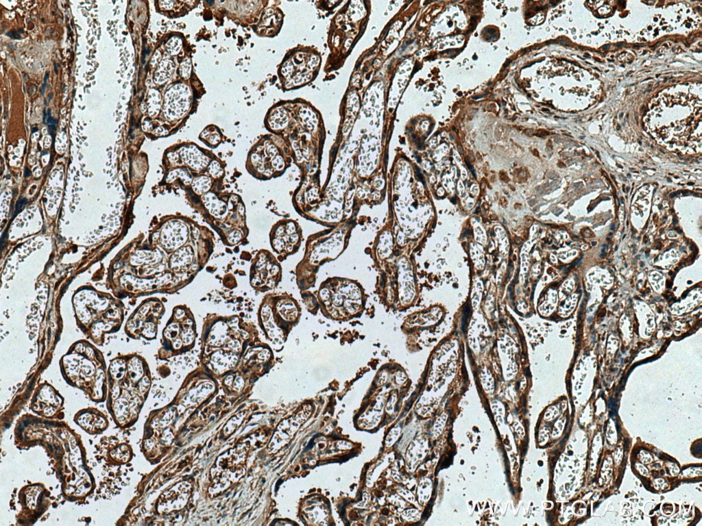 IHC staining of human placenta using 18236-1-AP