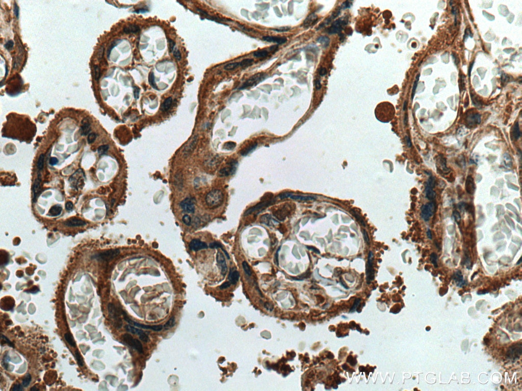 Immunohistochemistry (IHC) staining of human placenta tissue using TRPC6 Polyclonal antibody (18236-1-AP)