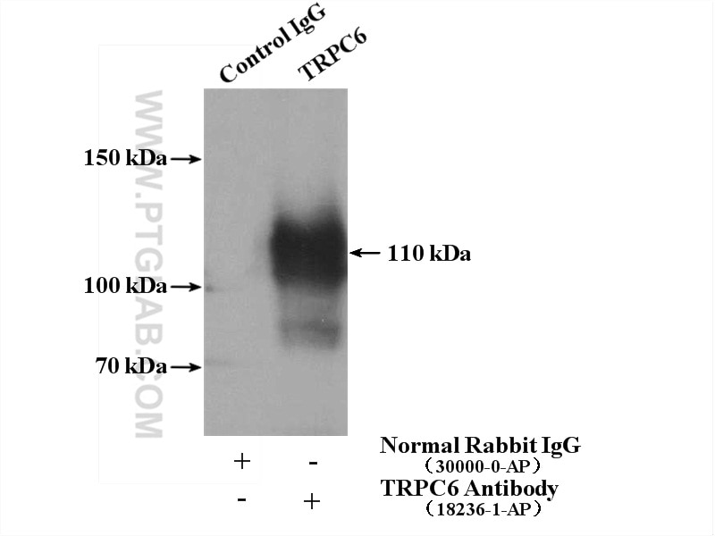Immunoprecipitation (IP) experiment of mouse lung tissue using TRPC6 Polyclonal antibody (18236-1-AP)