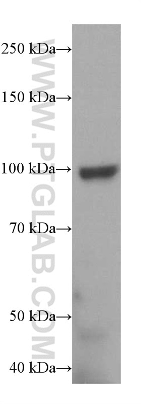 Western Blot (WB) analysis of mouse brain tissue using TRPC6 Polyclonal antibody (18236-1-AP)