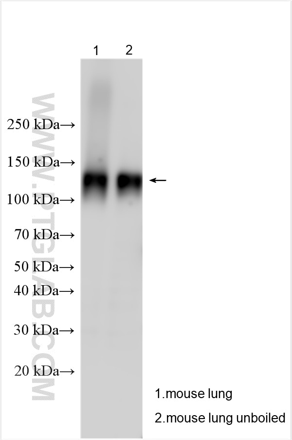 Western Blot (WB) analysis of various lysates using TRPC6 Polyclonal antibody (18236-1-AP)