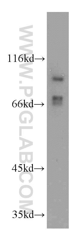 Western Blot (WB) analysis of COLO 320 cells using TRPC6 Polyclonal antibody (18236-1-AP)