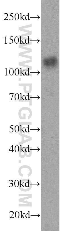 WB analysis of mouse lung using 18236-1-AP