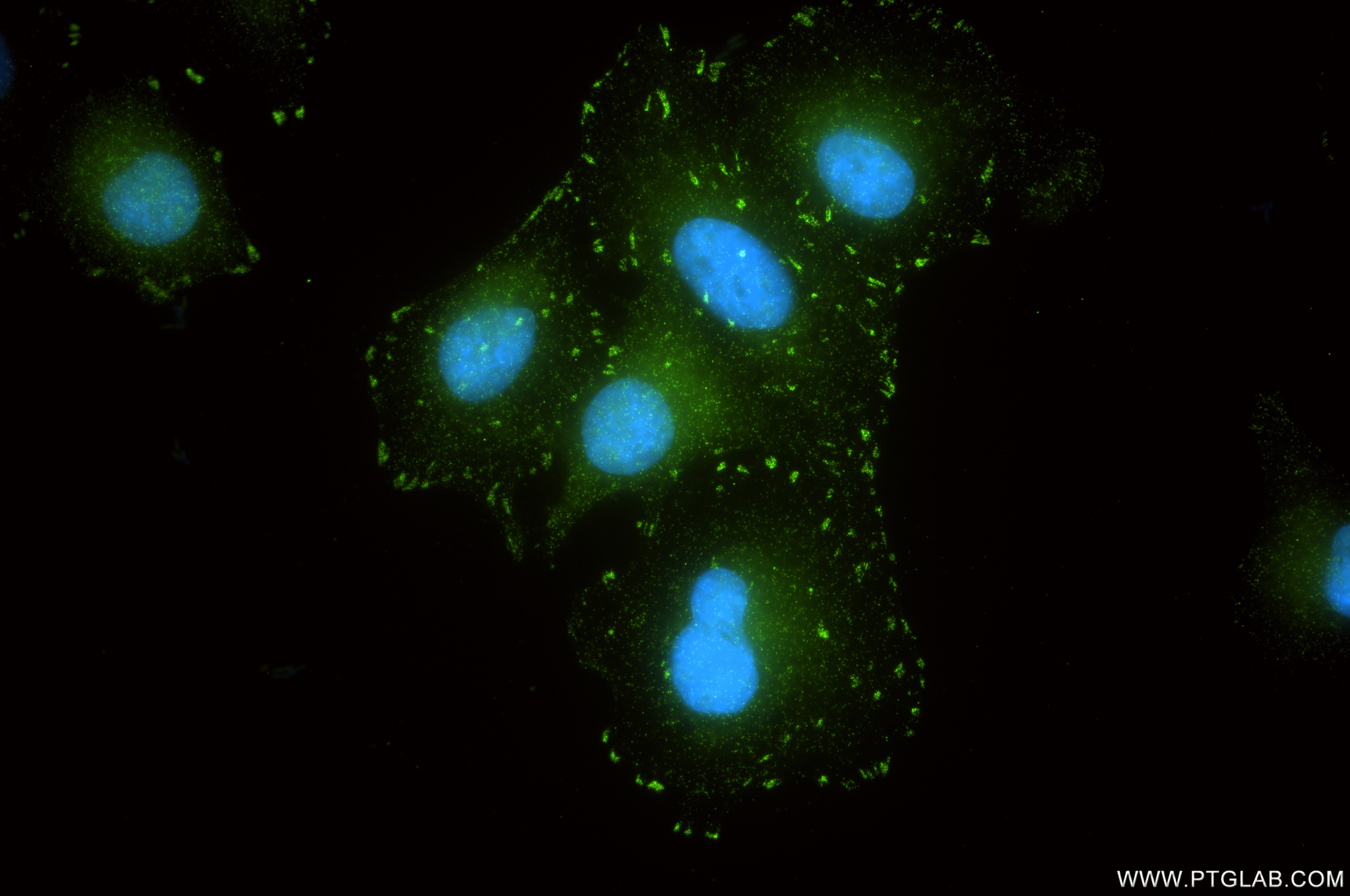 IF Staining of A549 using 84517-5-RR Immunofluorescence (IF) / fluorescent staining of A549 cells using TRPC6 Recombinant monoclonal antibody (84517-5-RR)