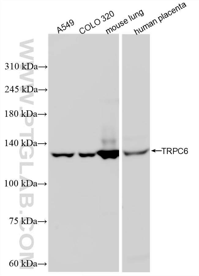 WB analysis using 84517-5-RR Western Blot (WB) analysis of various lysates using TRPC6 Recombinant monoclonal antibody (84517-5-RR)