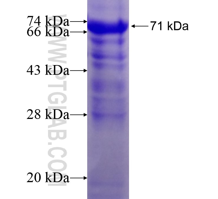TRPC6 fusion protein Ag12976 SDS-PAGE