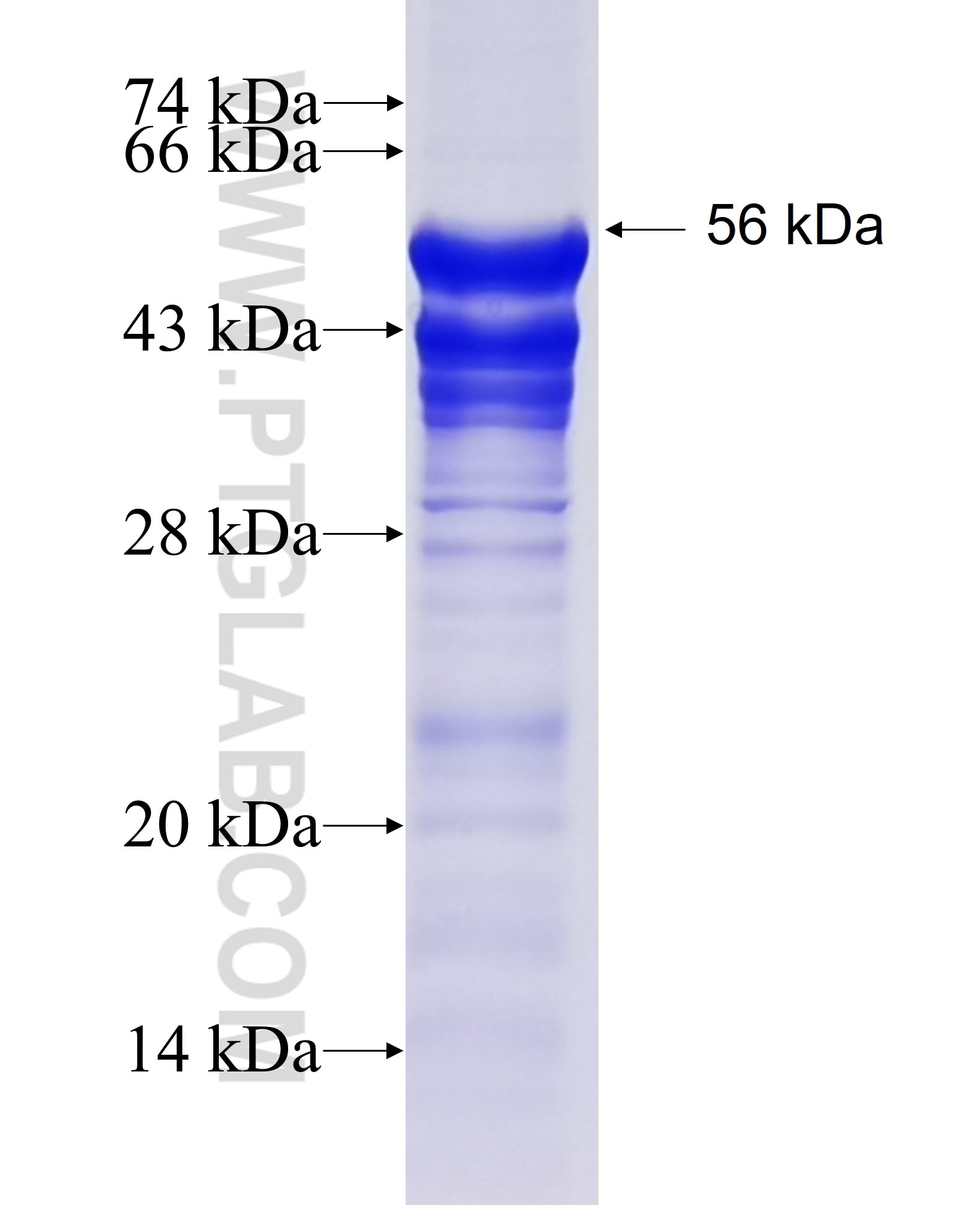 TRPC6 fusion protein Ag13314 SDS-PAGE TRPC6 fusion protein Ag13314 SDS-PAGE