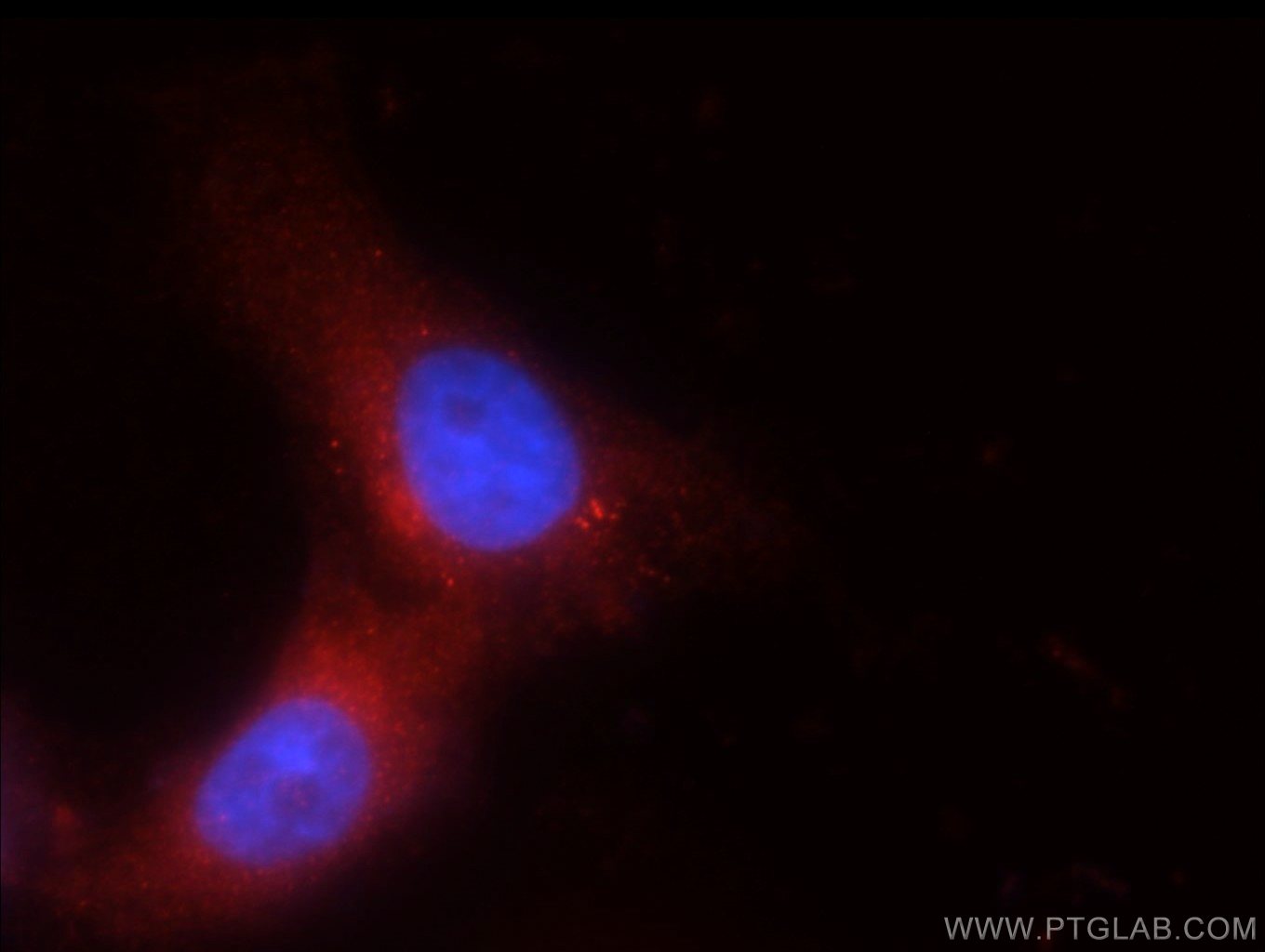 Immunofluorescence (IF) / fluorescent staining of SH-SY5Y cells using TRPM1 Polyclonal antibody (55111-1-AP)