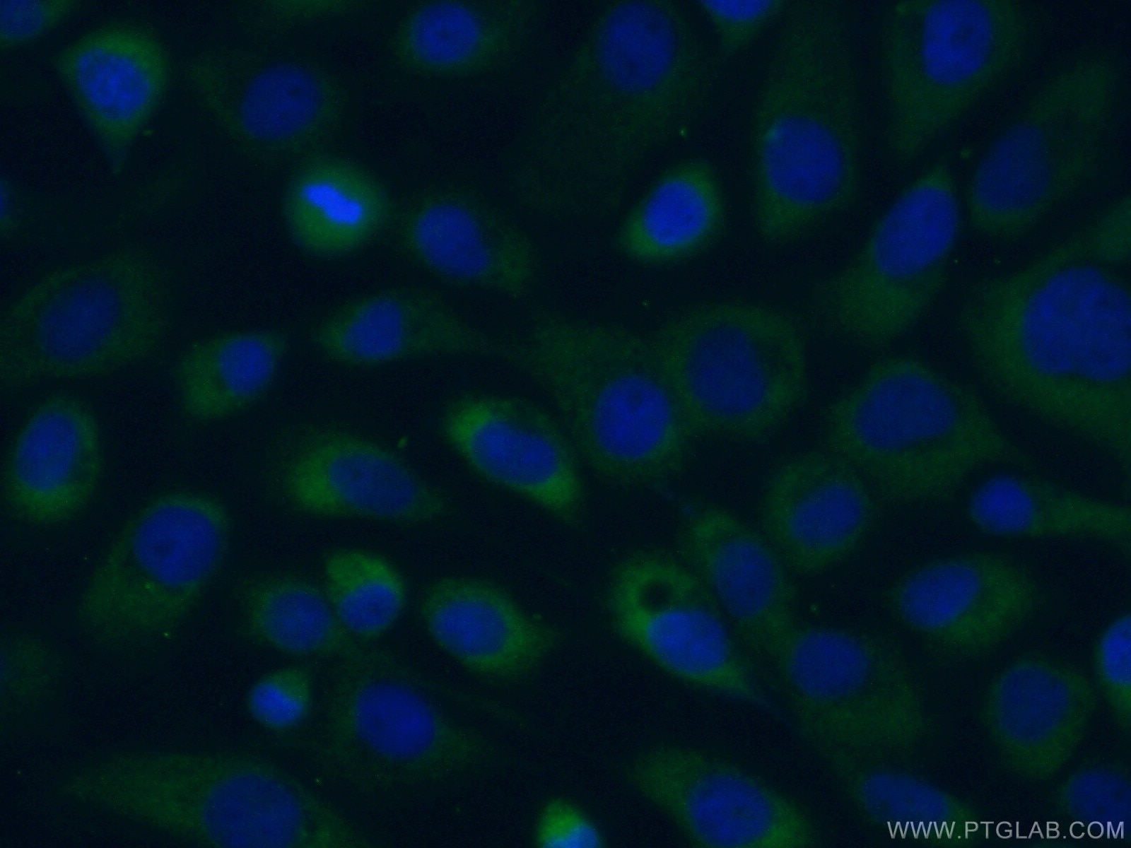 Immunofluorescence (IF) / fluorescent staining of A431 cells using TRPM1 Polyclonal antibody (55111-1-AP)