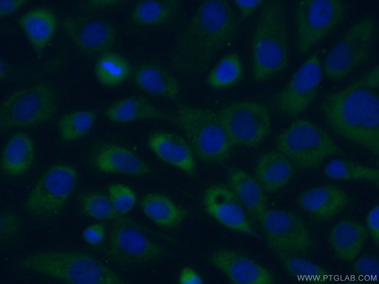 IF Staining of A431 using 55111-1-AP