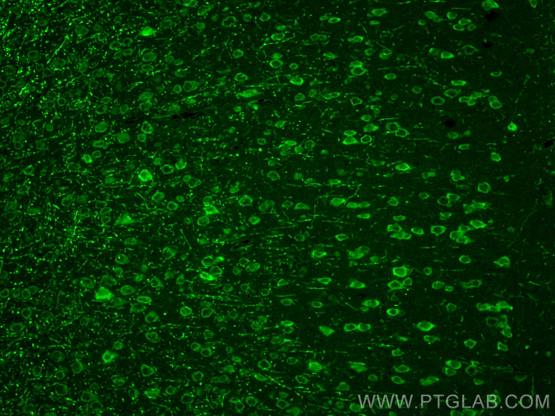 Immunofluorescence (IF) / fluorescent staining of mouse brain tissue using TRPM2 Polyclonal antibody (21842-1-AP)