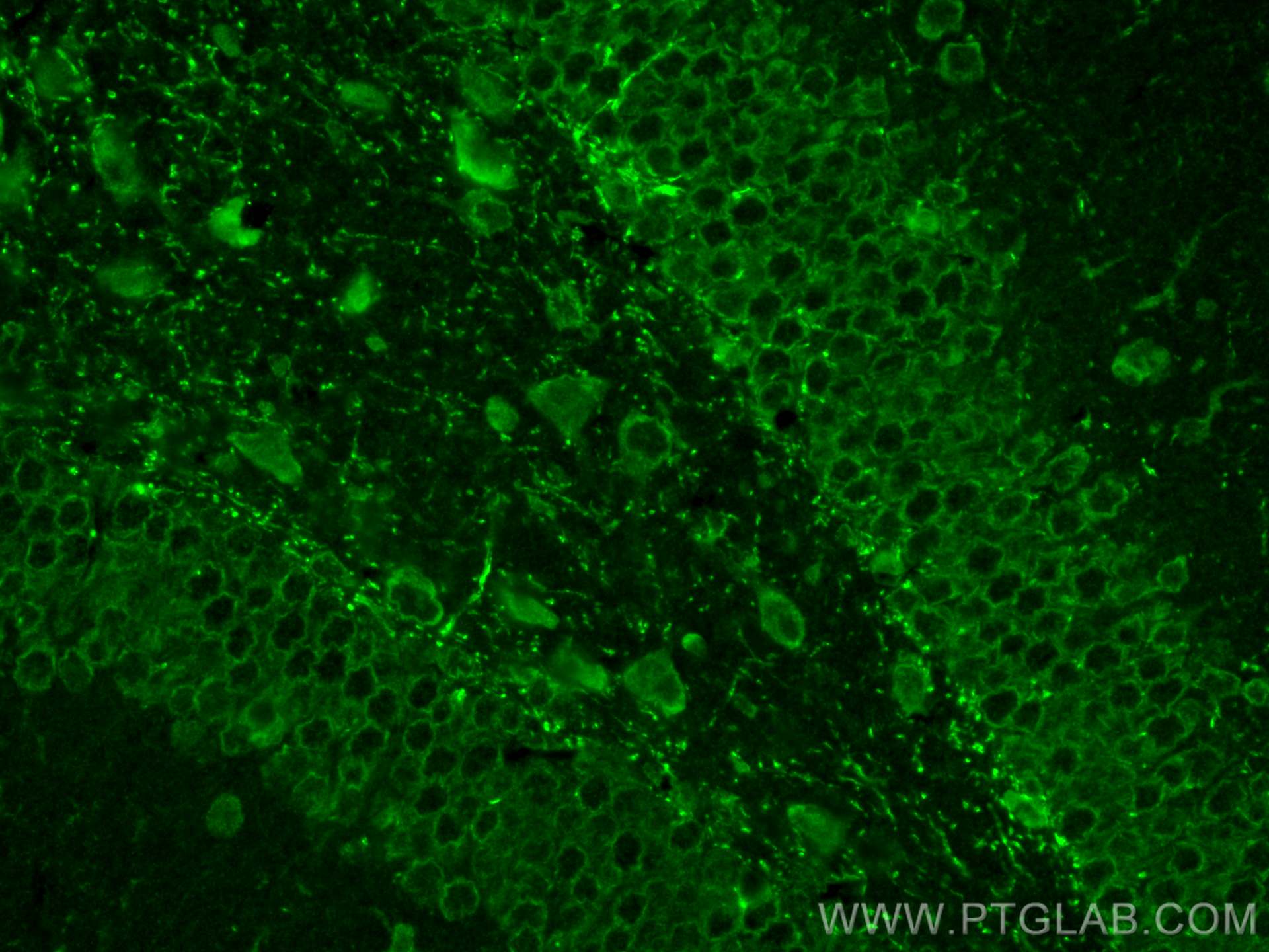 Immunofluorescence (IF) / fluorescent staining of mouse brain tissue using TRPM2 Polyclonal antibody (21842-1-AP)