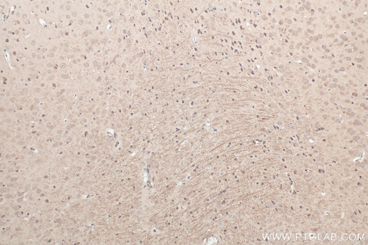 Immunohistochemistry (IHC) staining of mouse brain tissue using TRPM2 Polyclonal antibody (21842-1-AP)