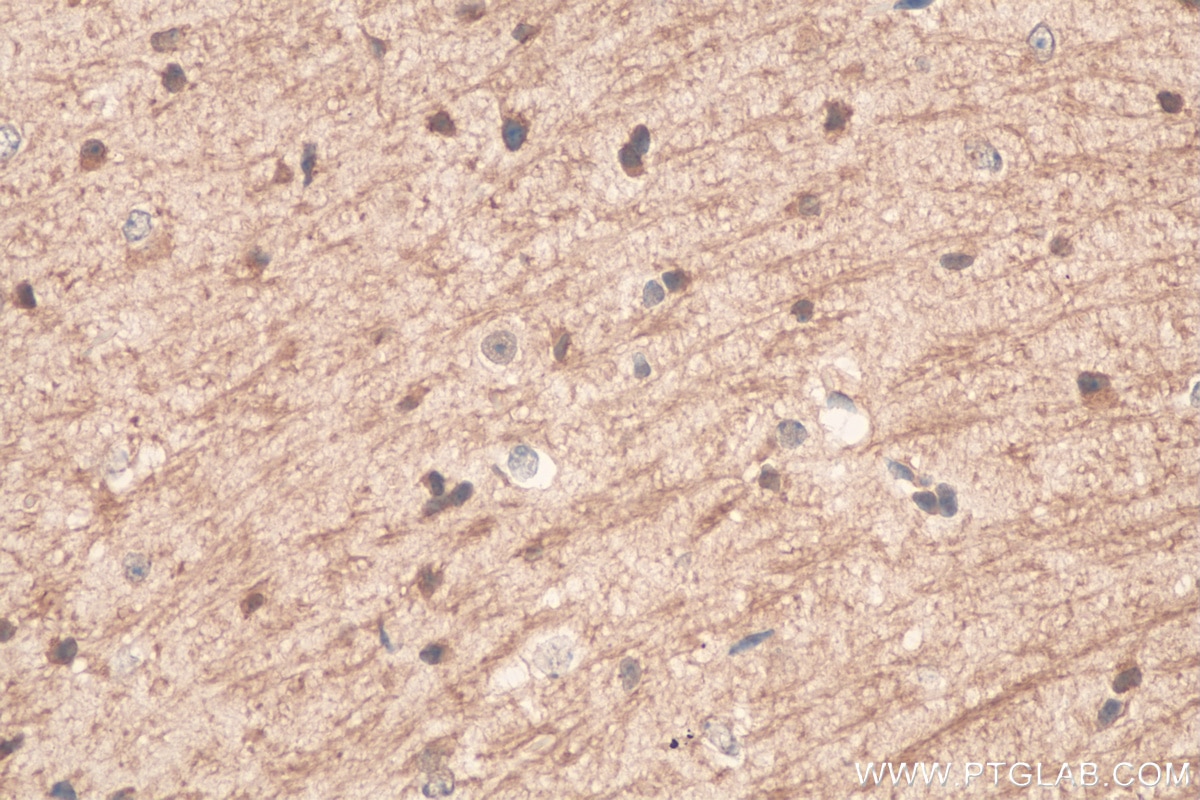 Immunohistochemistry (IHC) staining of mouse brain tissue using TRPM2 Polyclonal antibody (21842-1-AP)