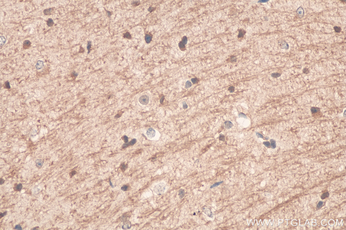 Immunohistochemistry (IHC) staining of mouse brain tissue using TRPM2 Polyclonal antibody (21842-1-AP)
