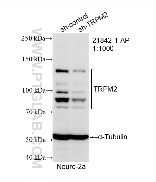Western Blot (WB) analysis of Neuro-2a cells using TRPM2 Polyclonal antibody (21842-1-AP)