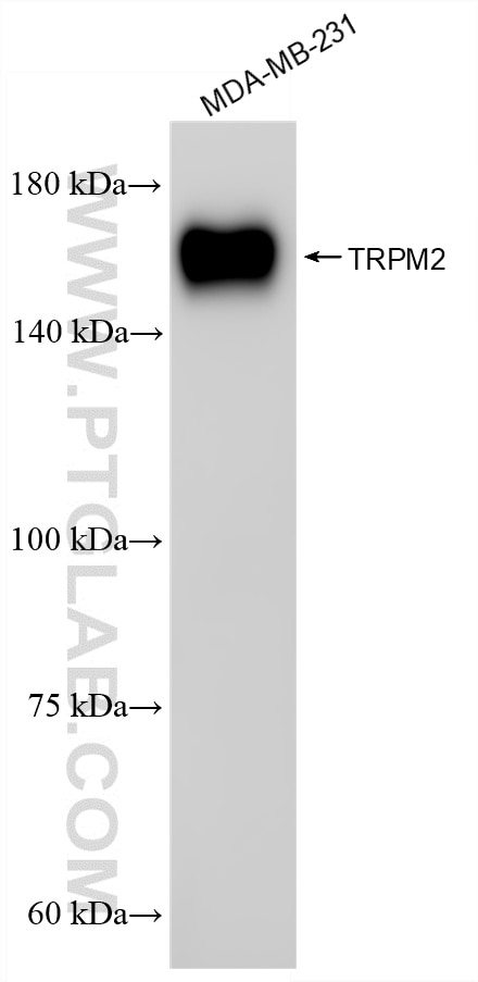 Western Blot (WB) analysis of MDA-MB-231 cells using TRPM2 Recombinant monoclonal antibody (87036-1-RR)