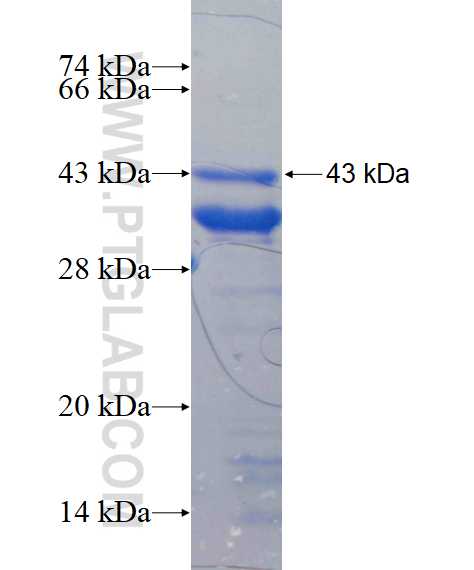 TRPM2 fusion protein Ag17172 SDS-PAGE