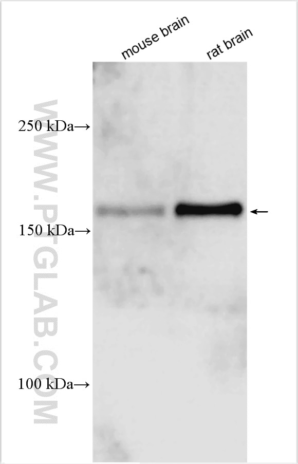 Western Blot (WB) analysis of various lysates using TRPM3 Polyclonal antibody (12724-1-AP)