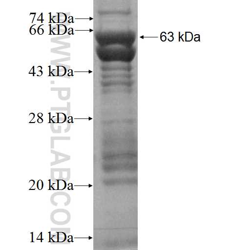 TRPM3 fusion protein Ag3421 SDS-PAGE