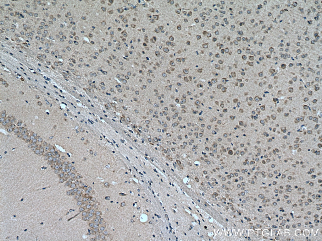 Immunohistochemistry (IHC) staining of mouse brain tissue using TRPM4 Polyclonal antibody (21985-1-AP)