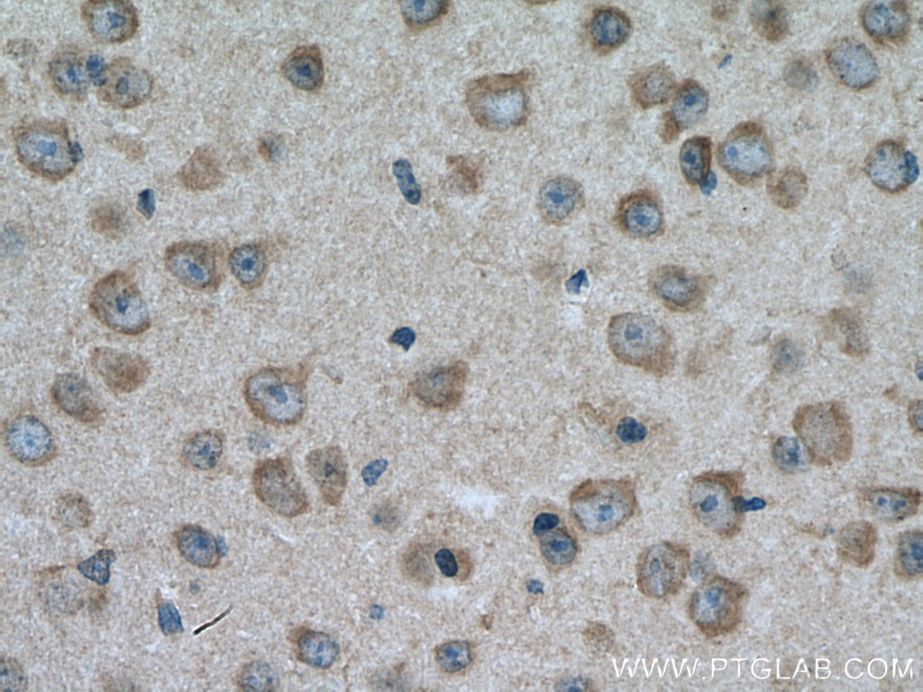 Immunohistochemistry (IHC) staining of mouse brain tissue using TRPM4 Polyclonal antibody (21985-1-AP)