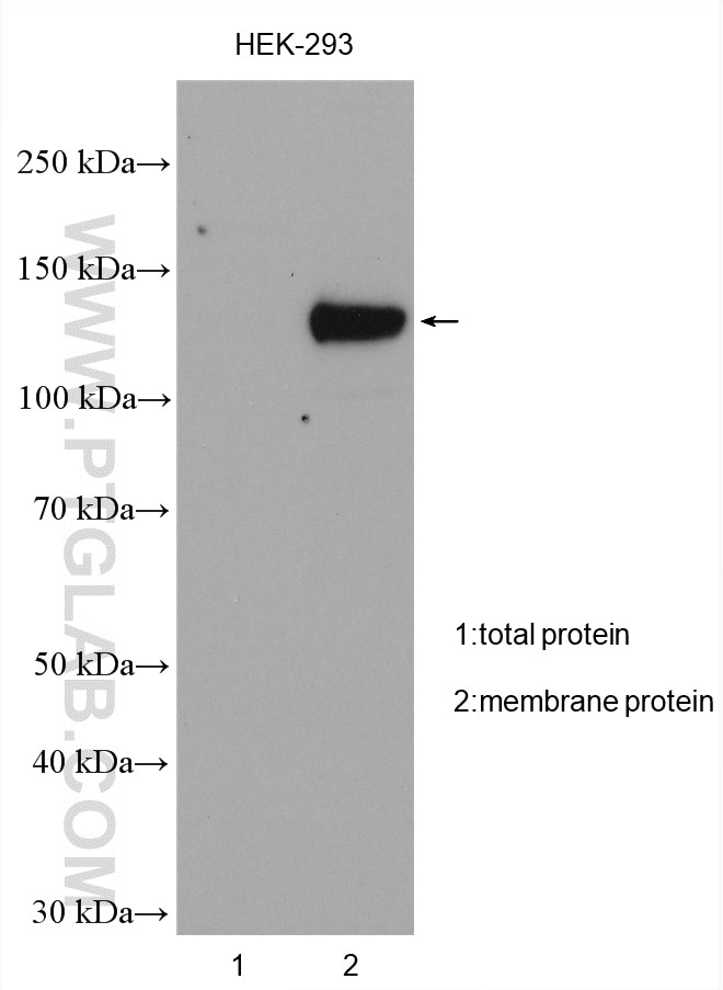 Western Blot (WB) analysis of various lysates using TRPM4 Polyclonal antibody (21985-1-AP)