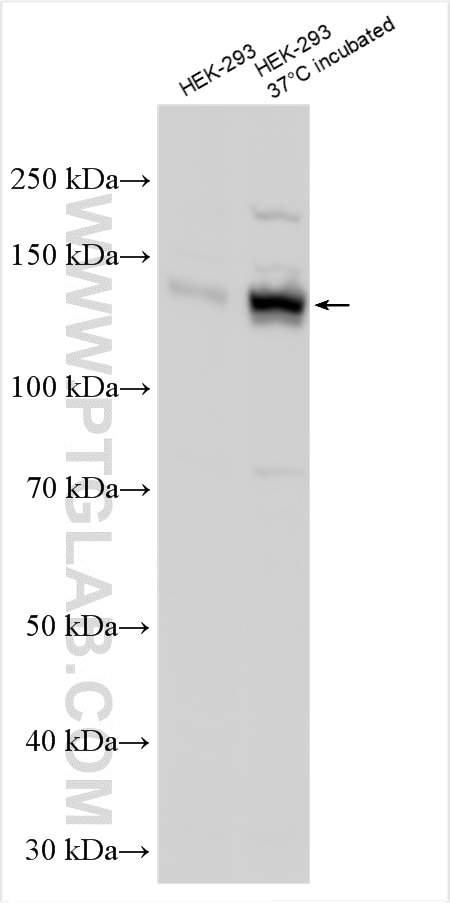 Western Blot (WB) analysis of various lysates using TRPM4 Polyclonal antibody (21985-1-AP)