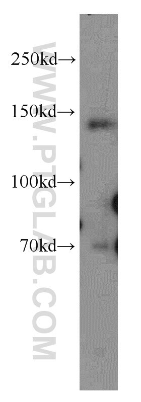 TRPM4