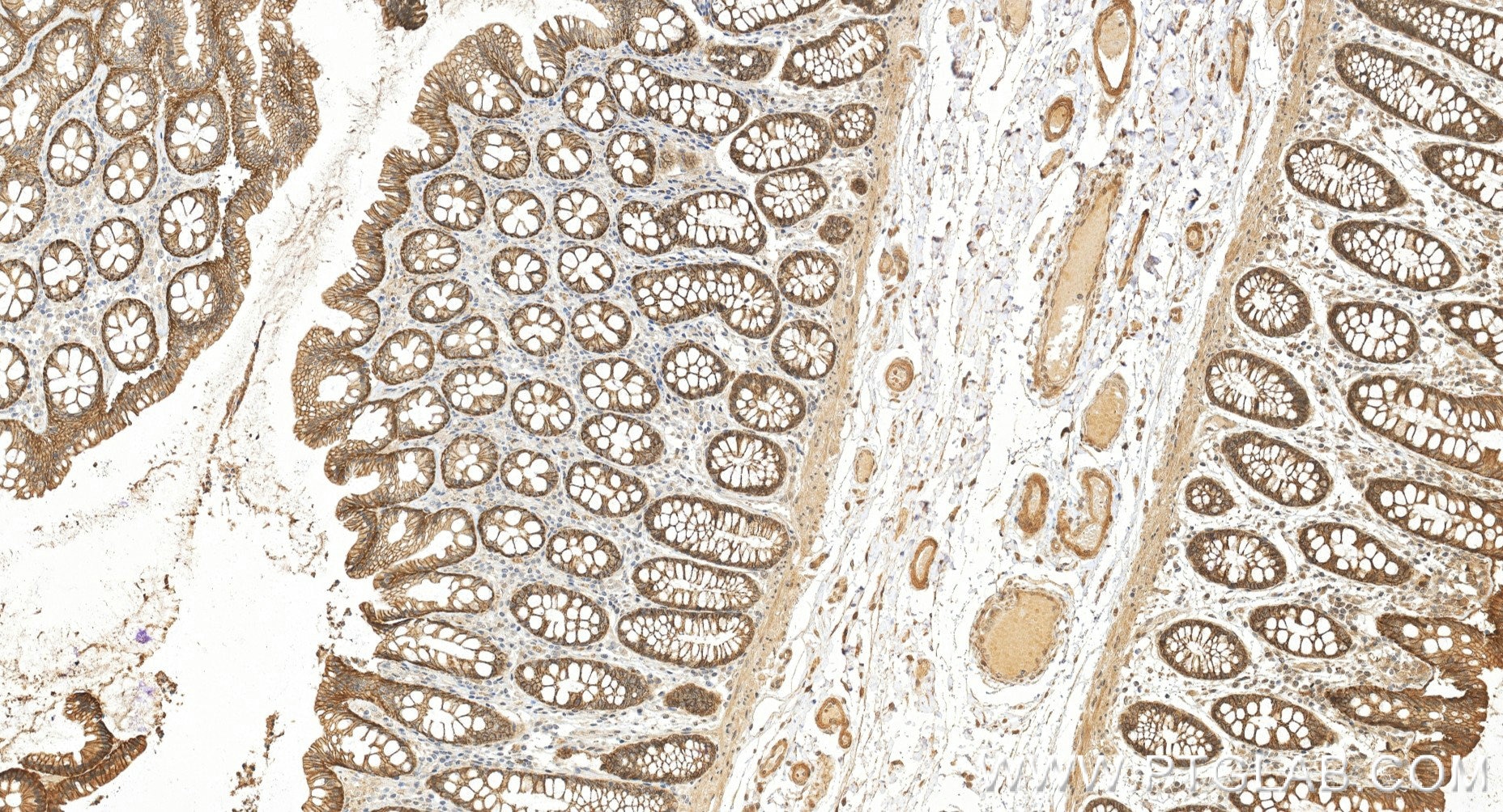 Immunohistochemistry (IHC) staining of human colon tissue using TRPM4 Recombinant monoclonal antibody (87085-1-RR)