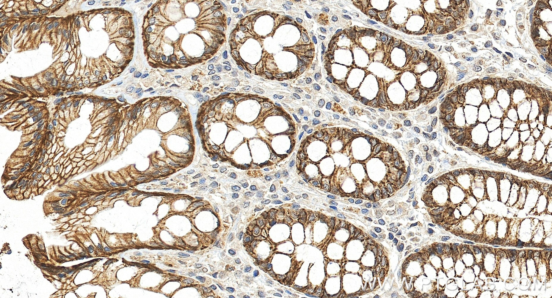 Immunohistochemistry (IHC) staining of human colon tissue using TRPM4 Recombinant monoclonal antibody (87085-1-RR)