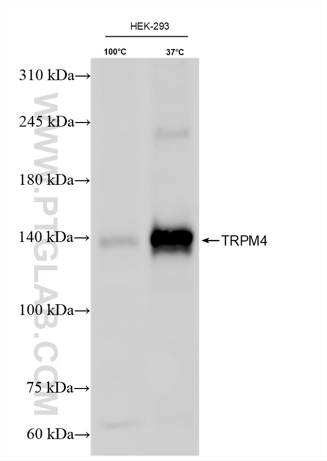 Western Blot (WB) analysis of various lysates using TRPM4 Recombinant monoclonal antibody (87085-1-RR)